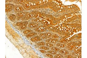 ABIN6263304 and ABIN6266596 at 1/100 staining Rat colon tissue by IHC-P.