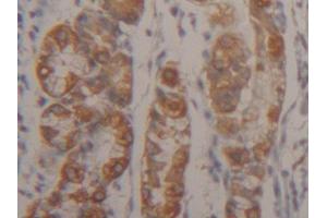 IHC-P analysis of Human Stomach Tissue, with DAB staining. (Cytokeratin 18 Antikörper  (AA 238-396))
