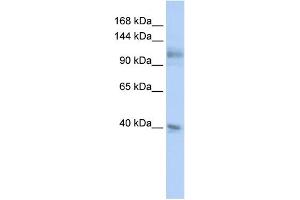 WB Suggested Anti-MSH2 Antibody Titration:  0. (MSH2 Antikörper  (N-Term))