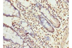 Immunohistochemistry of paraffin-embedded human small intestine tissue using ABIN7174649 at dilution of 1:100 (UGT3A2 Antikörper  (AA 23-300))