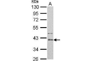 WB Image Arginase II antibody detects ARG2 protein by Western blot analysis. (ARG2 Antikörper  (Center))