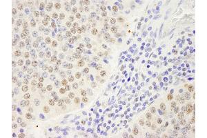 Immunohistochemistry (IHC) image for anti-Symplekin (SYMPK) (AA 1224-1274) antibody (ABIN7448822) (Symplekin Antikörper  (AA 1224-1274))