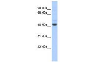 Image no. 1 for anti-PBX/knotted 1 Homeobox 1 (PKNOX1) (AA 215-264) antibody (ABIN6740367) (PKNOX1 Antikörper  (AA 215-264))