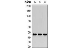 Western blot analysis of AChE Q expression in A549 (A), NS-1 (B), H9C2 (C) whole cell lysates. (COLQ Antikörper  (Center))