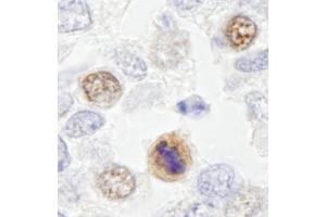 Immunohistochemistry (IHC) image for anti-Centromere Protein F (CENPF) (AA 2350-2400) antibody (ABIN7448938) (CENPF Antikörper  (AA 2350-2400))