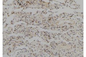 ABIN6257733 and ABIN6273708 at 1/100 staining Human lung tissue by IHC-P. (SYCP2 Antikörper  (Internal Region))