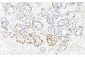 Immunohistochemistry (IHC) image for anti-Nucleoporin 50kDa (NUP50) (AA 418-468) antibody (ABIN7448703) (NUP50 Antikörper  (AA 418-468))