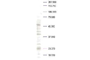 Western blot analysis is shown. (PLK1 Antikörper  (pThr210))