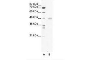 Image no. 1 for anti-LIM Domain Binding 1 (LDB1) (AA 251-300) antibody (ABIN6736052) (LIM Domain Binding 1 Protein Antikörper  (AA 251-300))