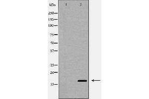 Western blot analysis of Interleukin 4 expression in MCF-7 cells,The lane on the left is treated with the antigen-specific peptide. (IL-4 Antikörper  (Internal Region))