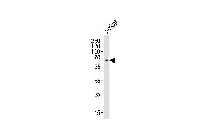Western blot analysis of lysate from Jurkat cell line, using IL2RG Antibody at 1:1000.