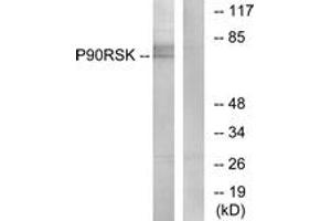 Western blot analysis of extracts from NIH-3T3 cells, treated with PMA 125ng/ml 30', using p90 RSK (Ab-573) Antibody. (RPS6KA3 Antikörper  (AA 539-588))