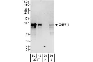 anti-Zinc Finger Protein 711 (AA 100-150) antibody