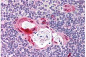 Human Thymus (formalin-fixed, paraffin-embedded) stained with TLR6 antibody ABIN214000 at 5 ug/ml followed by biotinylated goat anti-rabbit IgG secondary antibody ABIN481713, alkaline phosphatase-streptavidin and chromogen. (TLR6 Antikörper  (N-Term))
