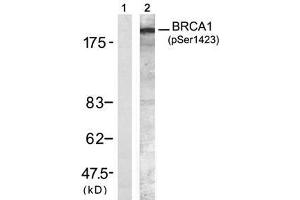 Image no. 1 for anti-Breast Cancer 1 (BRCA1) (pSer1423) antibody (ABIN273604) (BRCA1 Antikörper  (pSer1423))