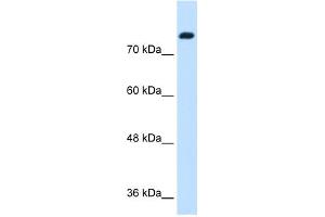 WB Suggested Anti-SNF1LK Antibody Titration:  1. (SIK1 Antikörper  (N-Term))