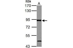 ABR Antikörper  (C-Term)