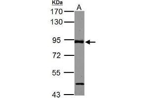 WB Image ABR antibody [C3], C-term detects ABR protein by Western blot analysis. (ABR Antikörper  (C-Term))