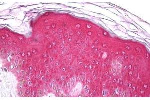 Anti-EPHA1 antibody IHC staining of human skin, epidermis. (EPHA1 Antikörper  (AA 913-943))
