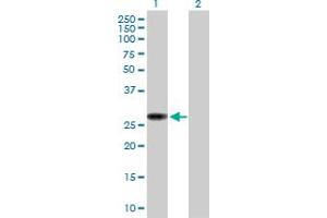Western Blot analysis of NAT9 expression in transfected 293T cell line by NAT9 MaxPab polyclonal antibody. (NAT9 Antikörper  (AA 1-207))