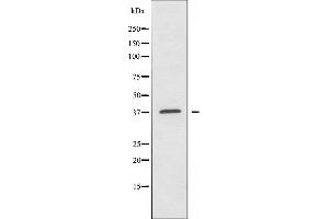 Western blot analysis of extracts from HUVEC cells, using AIM2 antibody.