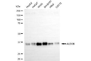 Western blotting analysis using ALDOB antibody (ABIN7797574).