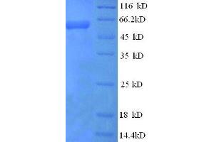 Protein expressed in E. (IL12B Protein (AA 23-327, full length) (His tag))