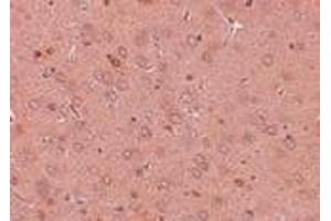 Immunohistochemistry (Paraffin-embedded Sections) (IHC (p)) image for anti-Golgi Membrane Protein 1 (GOLM1) (Center) antibody (ABIN499902)