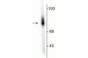 Western blot of human adrenal medulla lysate showing specific immunolabeling of the ~75 kDa DBH protein. (DBH Antikörper  (N-Term))