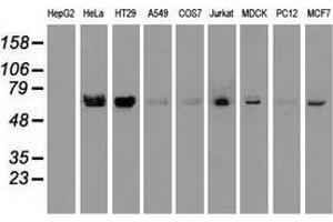 Western blot analysis of extracts (35 µg) from 9 different cell lines by using anti-NTRK2 monoclonal antibody. (TRKB Antikörper)