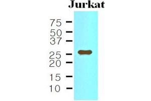 Western blot analysis: The Cell lysates of Jurkat (35ug) were resolved by SDS-PAGE, transferred to NC membrane and probed with anti-human IL-33 (1:500). (IL-33 Antikörper)