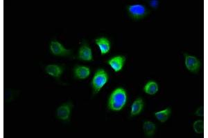Immunofluorescence staining of A549 cells with ABIN7165056 at 1:166, counter-stained with DAPI. (PRMT1 Antikörper  (AA 1-248))