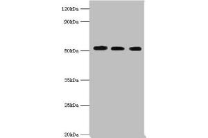 Western blot All lanes: Programmed cell death protein 4 antibody at 5 μg/mL Lane 1: Hela whole cell lysate Lane 2: MCF-7 whole cell lysate Lane 3: Jurkat whole cell lysate Secondary Goat polyclonal to rabbit IgG at 1/10000 dilution Predicted band size: 52, 51 kDa Observed band size: 52 kDa (PDCD4 Antikörper  (AA 1-260))