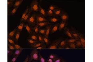 Immunofluorescence analysis of U-2 OS cells using CBX3 Polyclonal Antibody at dilution of 1:100. (CBX3 Antikörper)