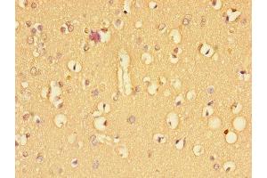 Immunohistochemistry (IHC) image for anti-Transforming Growth Factor, beta Receptor II (70/80kDa) (TGFBR2) (AA 25-159) antibody (ABIN7171961)