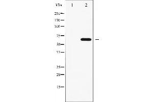 Western blot analysis of FRS2 phosphorylation expression in COS7 whole cell lysates,The lane on the left is treated with the antigen-specific peptide.