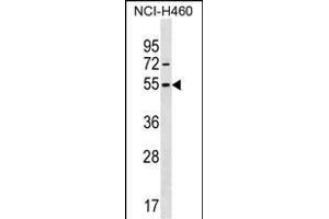 MIER1 Antikörper  (AA 214-242)