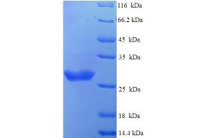 SDS-PAGE (SDS) image for Bovine Coronavirus Spike Protein (BCoV S) (AA 326-540), (partial) protein (His tag) (ABIN5710878) (Bovine Coronavirus Spike Protein (AA 326-540, partial) (His tag))