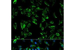 Immunofluorescence analysis of HeLa cells using TPM3 Polyclonal Antibody (TPM3 Antikörper)