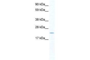 Western Blotting (WB) image for anti-SERTA Domain Containing 1 (SERTAD1) antibody (ABIN2460913) (SERTAD1 Antikörper)