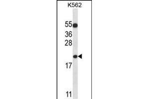 BAX Antibody (N-term) (ABIN657135 and ABIN2846276) western blot analysis in K562 cell line lysates (35 μg/lane). (BAX Antikörper  (N-Term))