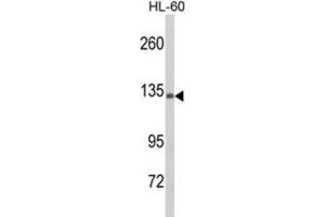 Western Blotting (WB) image for anti-Complement Component 5 (C5) antibody (ABIN3003812)