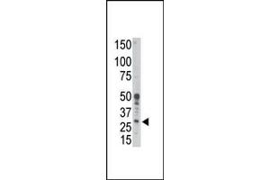 BCL2A1 Antikörper  (Ala1)