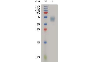 SDS-PAGE (SDS) image for Plasminogen Activator, Urokinase Receptor (PLAUR) (AA 23-303) protein (His tag) (ABIN7491105)