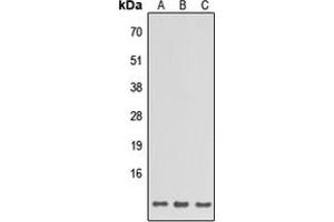 Western blot analysis of SPINK6 expression in HeLa (A), Raw264. (SPINK6 Antikörper  (Center))