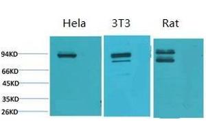 Western Blot (WB) analysis of 1) HeLa, 2) 3T3, 3) Rat Heart Tissue using Stat1 Polyclonal Antibody. (STAT1 Antikörper)