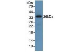 Western blot analysis of recombinant Human ROS1. (ROS1 Antikörper)