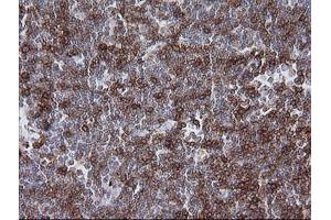 Immunohistochemistry (IHC) image for anti-T-cell surface glycoprotein CD1c (CD1C) antibody (ABIN2670667) (CD1c Antikörper)