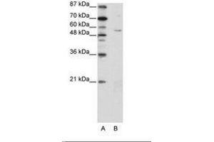 Image no. 1 for anti-Zinc Finger Protein 329 (ZNF329) (N-Term) antibody (ABIN202735) (ZNF329 Antikörper  (N-Term))