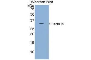 Detection of Recombinant CDH16, Mouse using Polyclonal Antibody to Cadherin 16 (CDH16) (Cadherin-16 Antikörper  (AA 353-617))